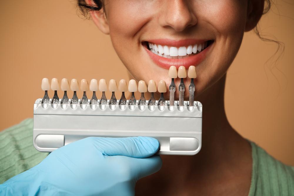 Transform Your Smile With Veneers